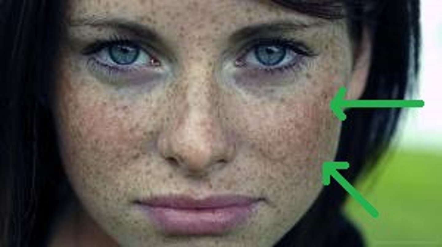 <p>He/She has freckles.</p>