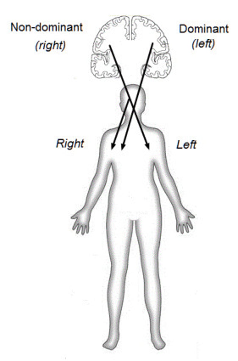 <p>right parietal cortex monitors both sides of space while left parietal cortex monitors only right</p>