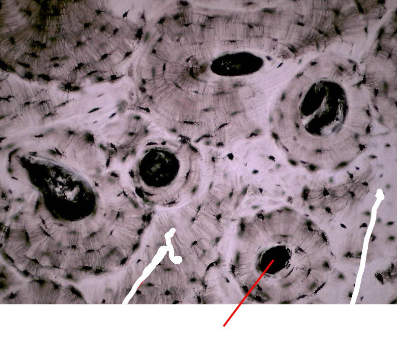 <p>What part of human bone tissue is this?</p>