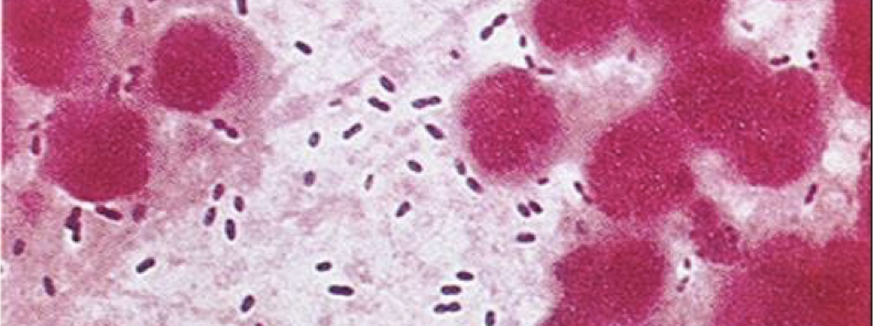 <p>What am i- gram stain, shape, arrangement</p>