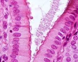 <p>the cells of the intestinal lining pictured above are an example of a </p>