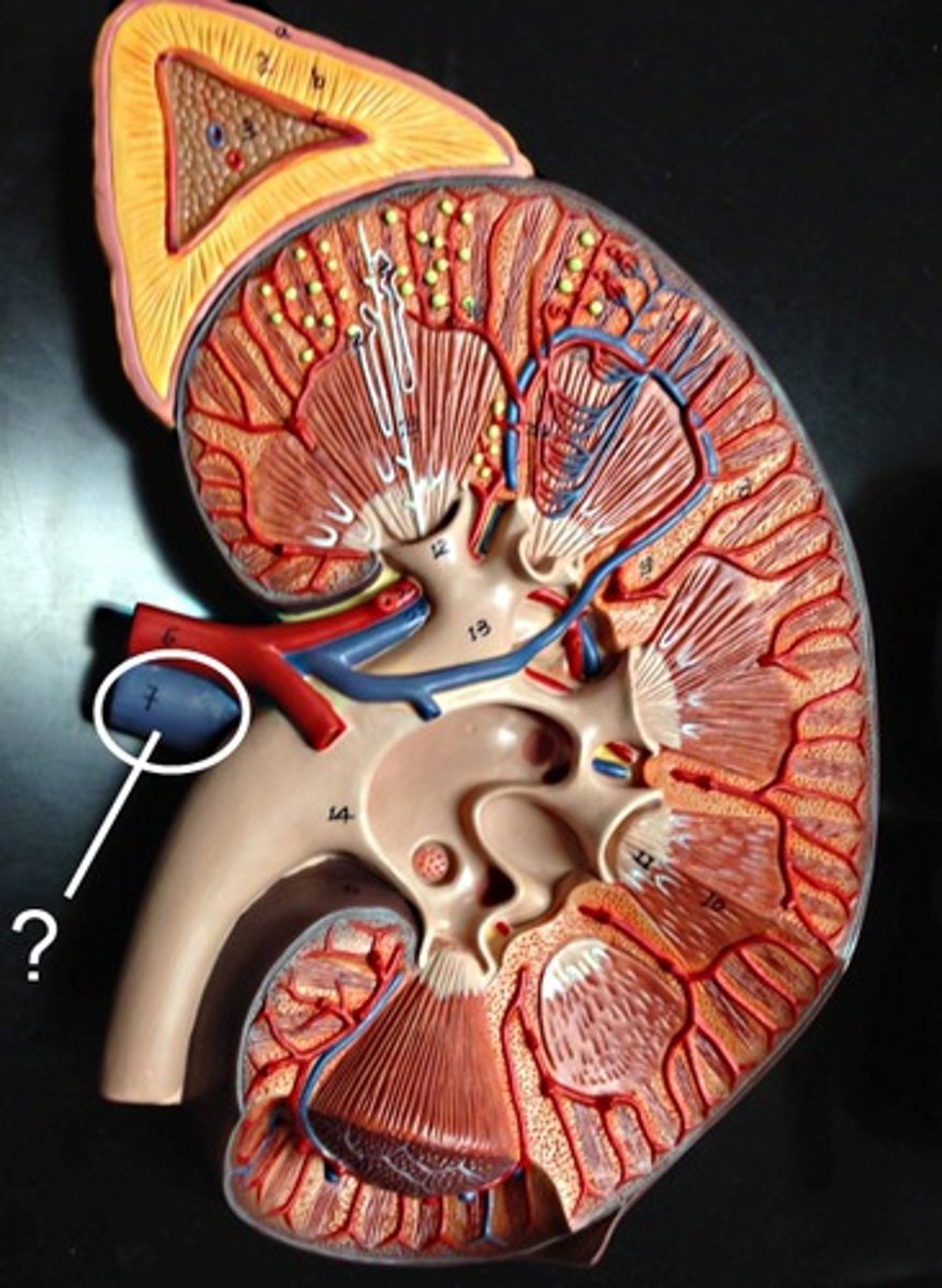 <p>Name this vessel.</p>