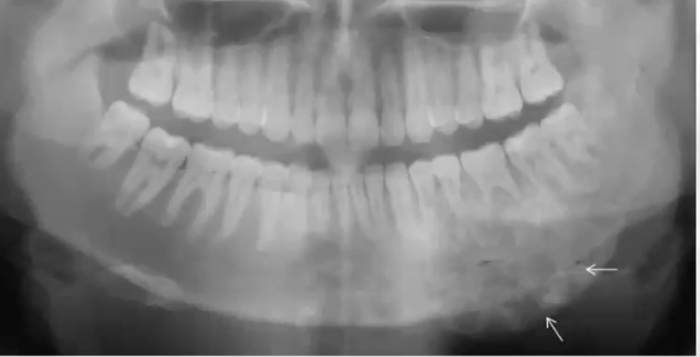 <p>diagnosis?</p>