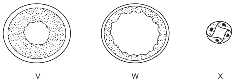 <p>which one is the artery </p>