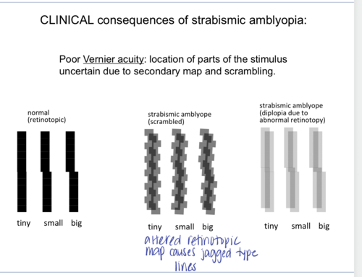 <p>Individuals with strabismus will have (good/poor) Vernier acuity</p>