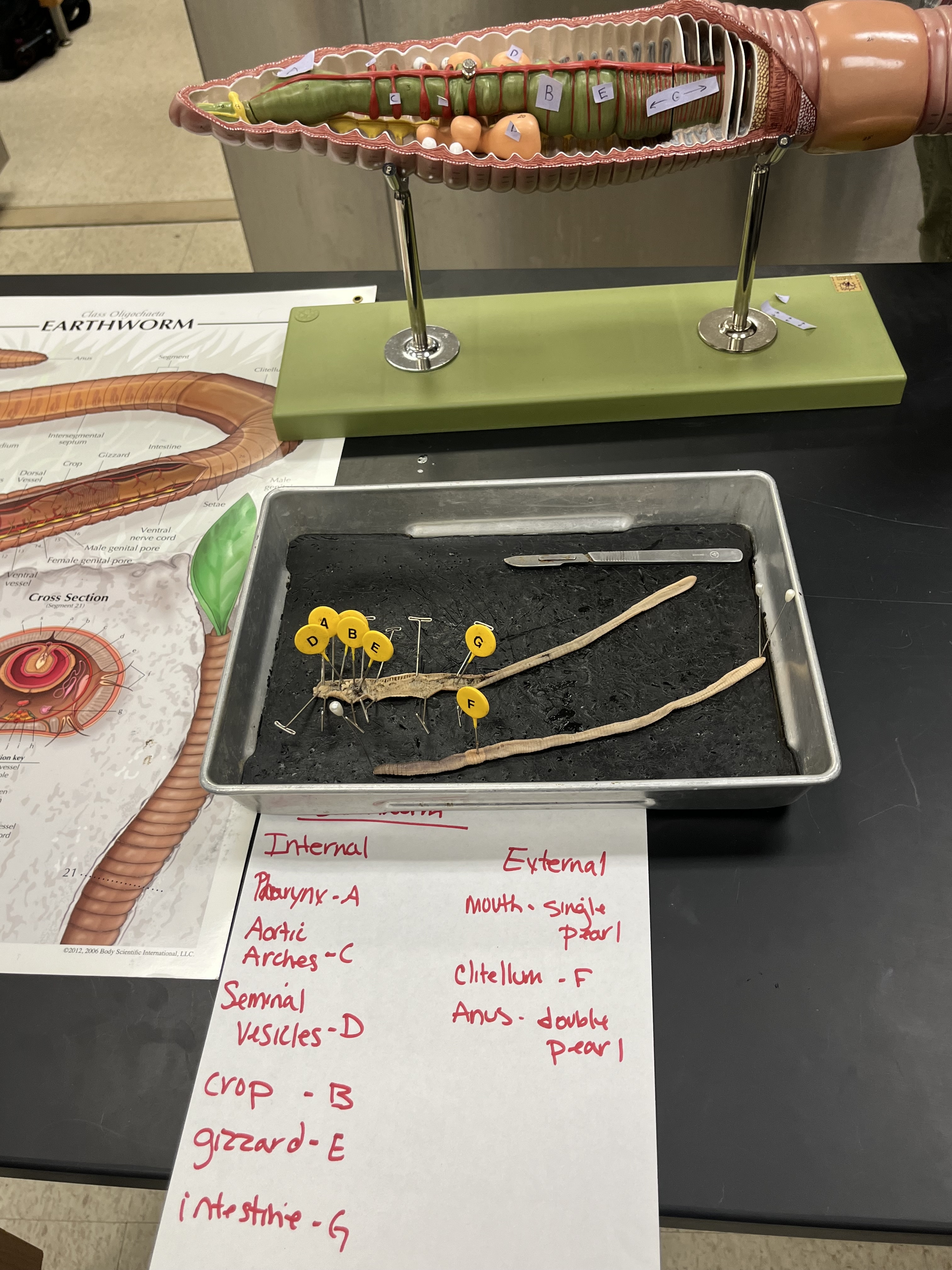 <p>Dissected Earthworm</p>