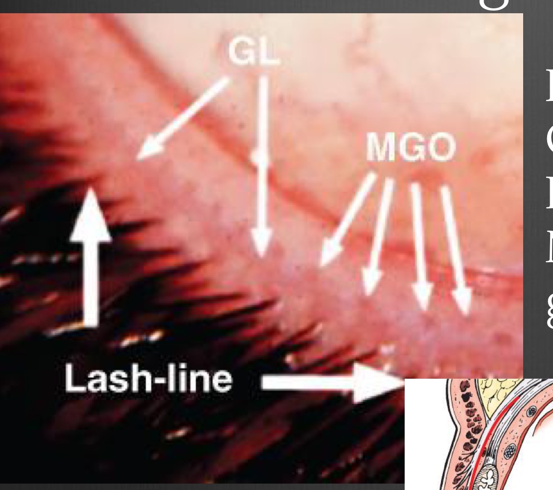 MGOs, Grey line, Lashes