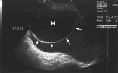 What does the arrows tell you in this image?