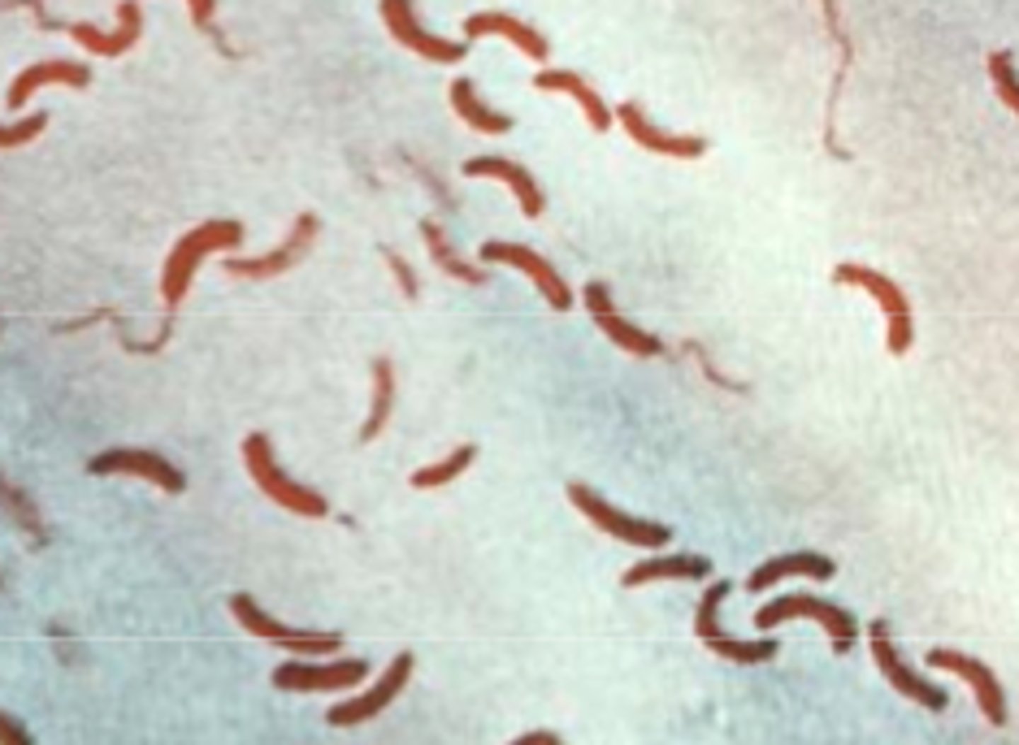 <p>an acute intestinal infection caused by ingestion of contaminated water or food</p><p>holera is a bacterial disease transmitted through contaminated water, causing tens of thousands of deaths annually, primarily in developing countries.</p><p>Prevention methods include boiling or chlorinating drinking water, practicing proper hygiene, and quickly rehydrating infected individuals.</p><p>Although cholera vaccines are available, they are not a substitute for preventive measures, and the disease can be fatal if not promptly treated.</p>