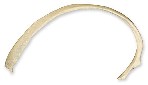 Identify this bone