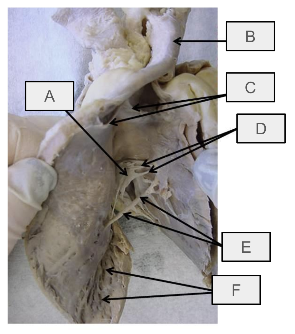 <p>What is F</p>