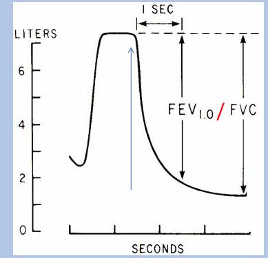 <p>-FEV1/FVC ratio- typical value is 80%</p>