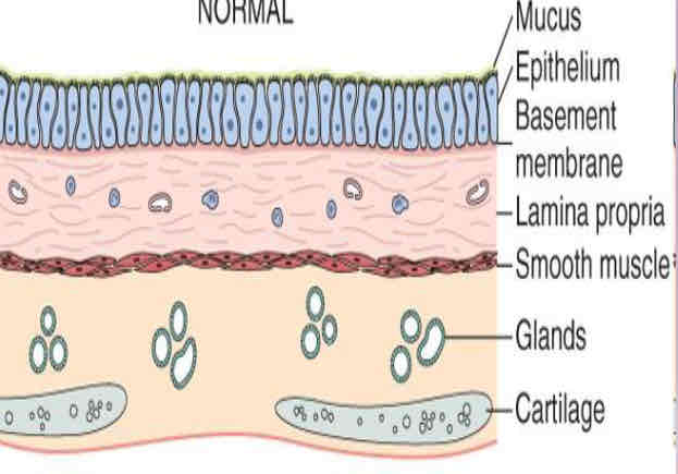 <p>What are the airway layers?</p>