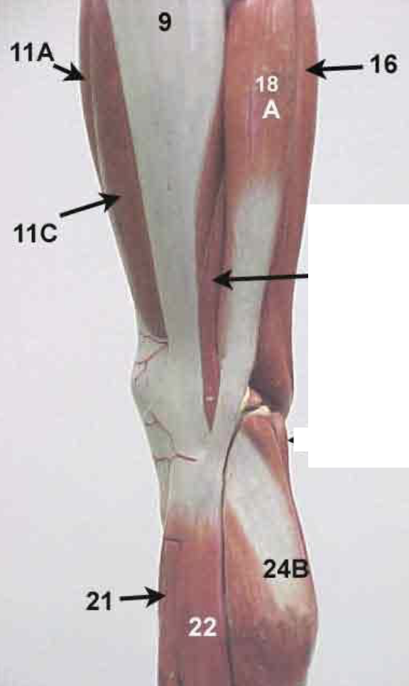 <p>What muscle is this? <strong>(24 B) </strong>*****</p>
