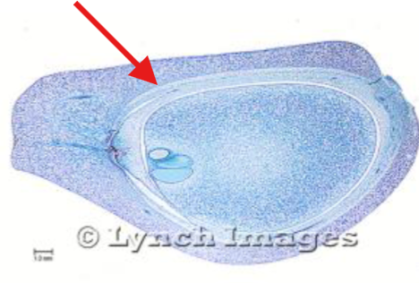 <p>What is being indicated on the Zamia Ovule?</p>