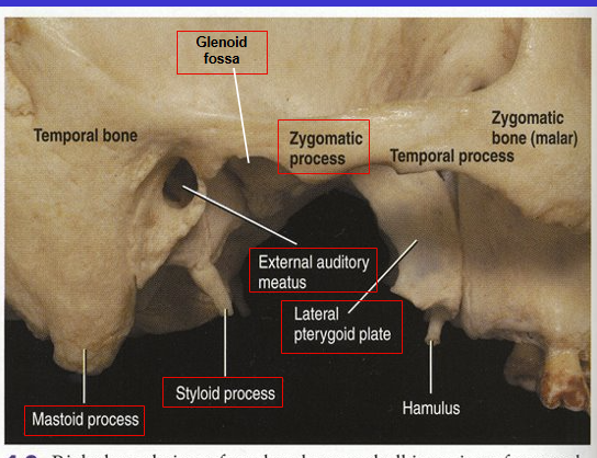 <p>External acoustic (auditory) meatus</p><ul><li><p>is the ear hole</p></li></ul><p></p>