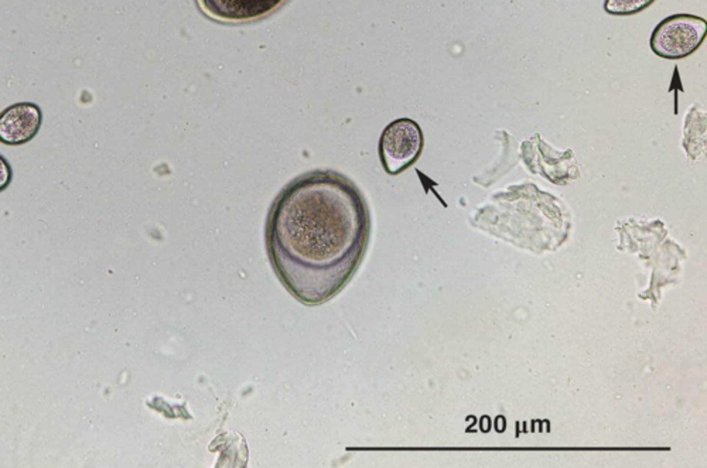 <p>What is the larger parasite if it is from a cat</p>