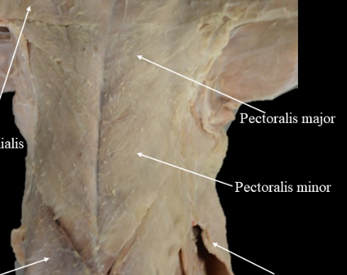 <p>Under the Pectoralis Major</p>