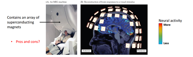 <p>A method that measures changes in tiny magnetic fields produced by neuronal activity, providing information about populations of neurons.</p>