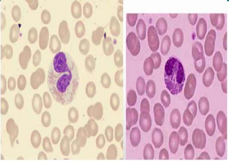 <p> Bilobed nucleus </p><p> Eosinophilic cytoplasm </p><p> Increased in helminthic and parasitic infections </p><p> Increased in allergic reactions</p>
