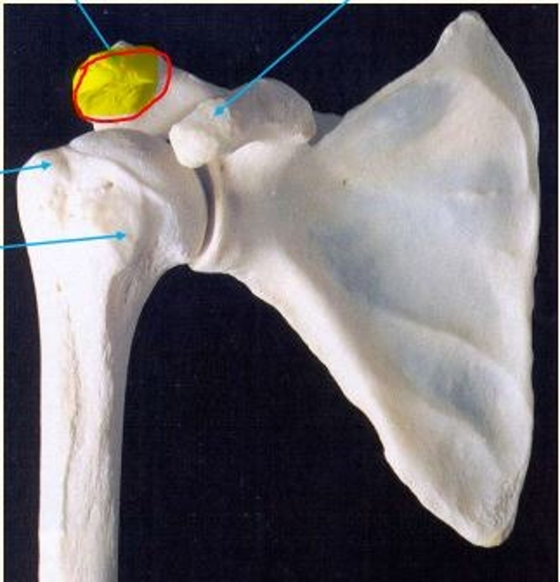 <p>Acromion</p><p>Palpable bony shelf above the shoulder</p>