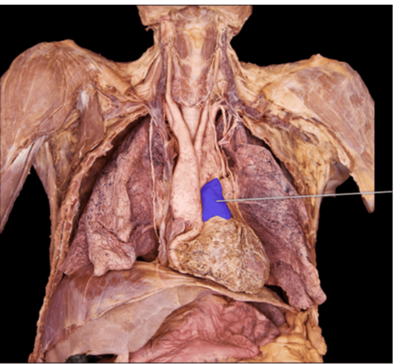 <p>right ventricle</p>