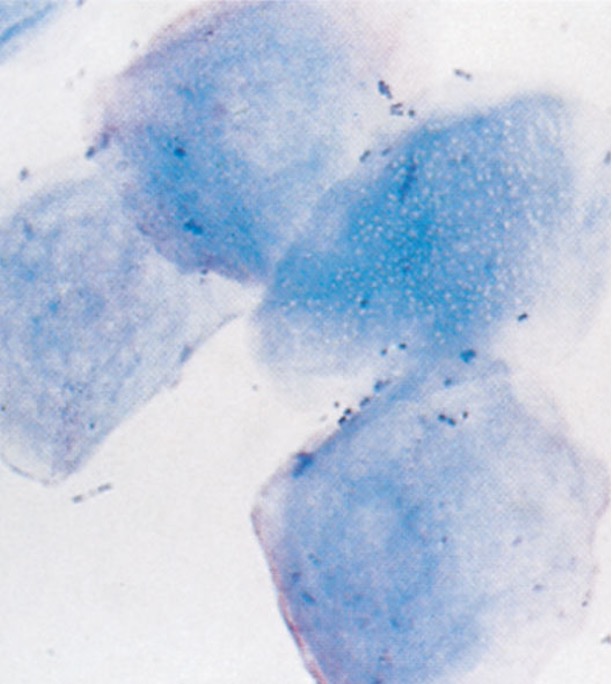 <p>Which epithelial cell type is characterized as the largest, pyknotic nucleus, irregular, flat, or boxy borders?</p>