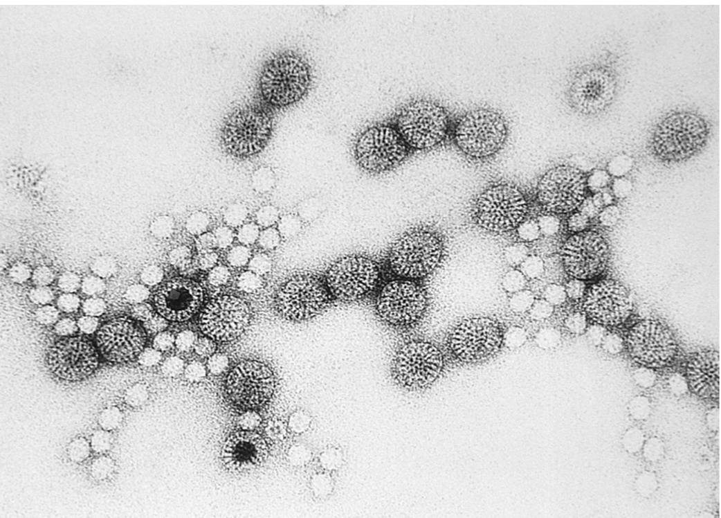 <ul><li><p>Small, nonenveloped, dsRNA</p></li><li><p><strong> “Rota” is Latin word for “wheel” and describes morphology of the virus</strong></p></li><li><p> Double capsid seen with electron microscope resembles wheel with wide hub and short spokes radiating from hub to rim of the wheel</p><p></p></li><li><p><strong> Transmission via fecal-oral route</strong></p><ul><li><p> Transmission is often via contaminated water and foods such as oysters, clams, and raw shellfish</p></li></ul></li><li><p> Infection may be asymptomatic, mild, or severe dehydrating diarrheal illness</p><ul><li><p> Symptoms: fever, vomiting, diarrhea, and dehydration due to water loss</p></li></ul></li><li><p> Most cases in infants 16-24 months of age</p><ul><li><p> Most common cause of severe diarrhea</p></li><li><p> Leading cause of mortality</p></li><li><p> In developing countries, many children succumb to complications of infection</p></li></ul></li></ul><p></p>