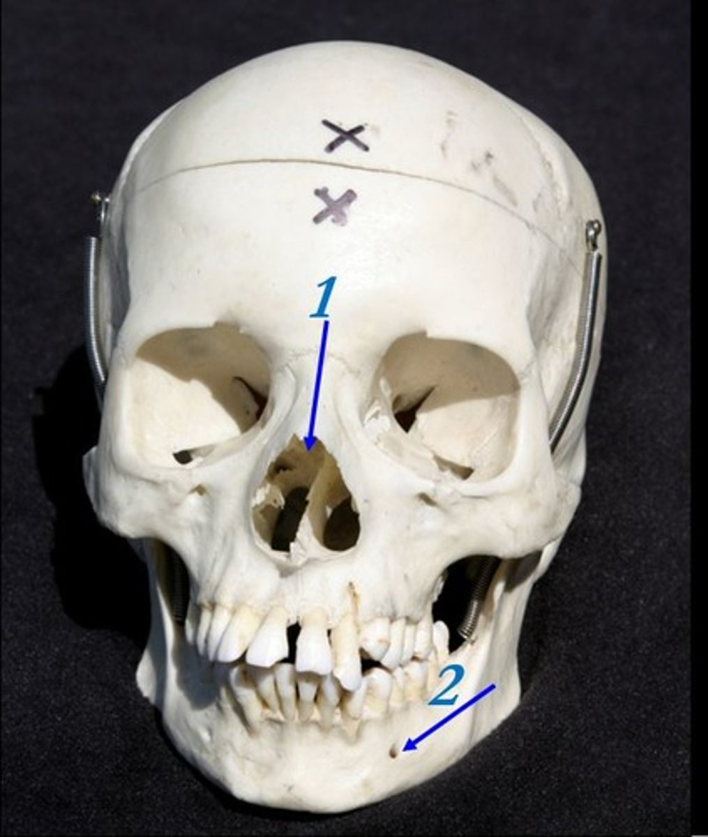 <p>What is #1 pointing to? (the entire cavity)</p>