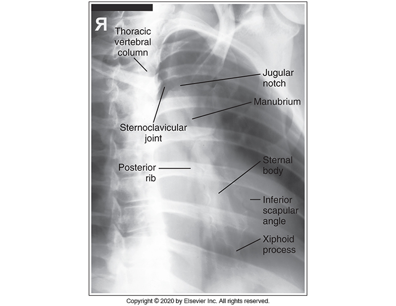 <p>RAO - PA Oblique Sternum - Image labeled</p>