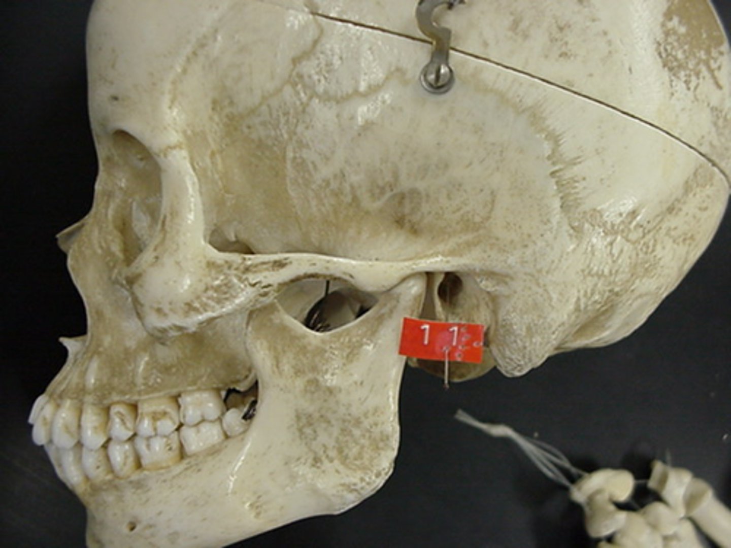 <p>ear canal</p>