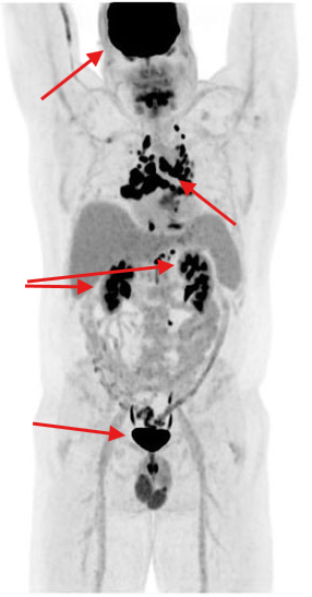 <ul><li><p><span>Brain</span></p></li><li><p><span>Kidneys&nbsp;</span></p></li><li><p><span>Bladder&nbsp;</span></p></li><li><p><span>Variable of the heart&nbsp;</span></p></li></ul><p></p>