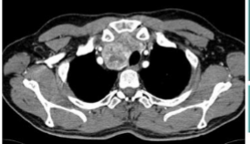 <p>what is this and what kind of scan </p>