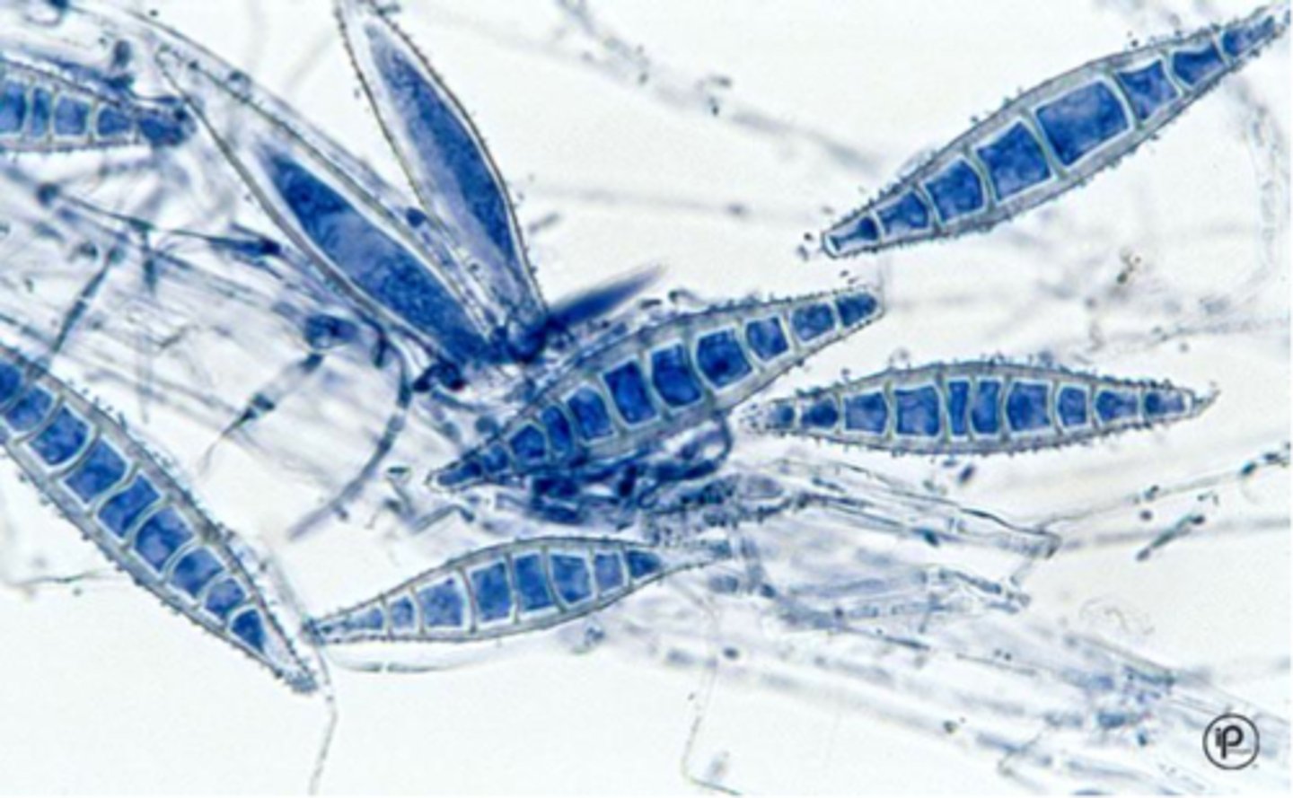 <p>Colony: downy, white-yellow</p><p>Reverse: orange-yellow</p><p>Microconidia: rare</p><p>Macroconidia: fusiform spindle, septate macroconidia, thick cell wall, echinulate, 3-15 cells</p><p>septate hyphae</p><p>Conditions: scalp and skin; </p><p>--dogs, cats, farm animals</p>