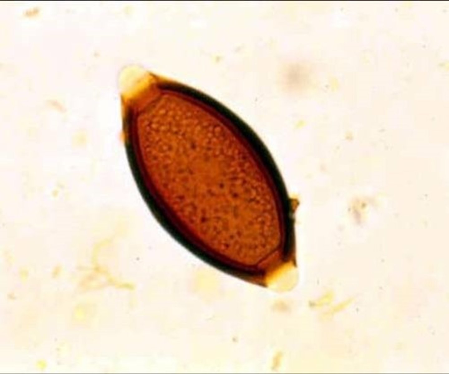 <p>whipworms of ruminants</p>