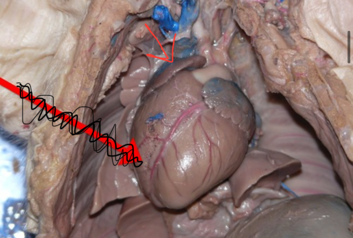 <p>Receives blood returning to heart</p>