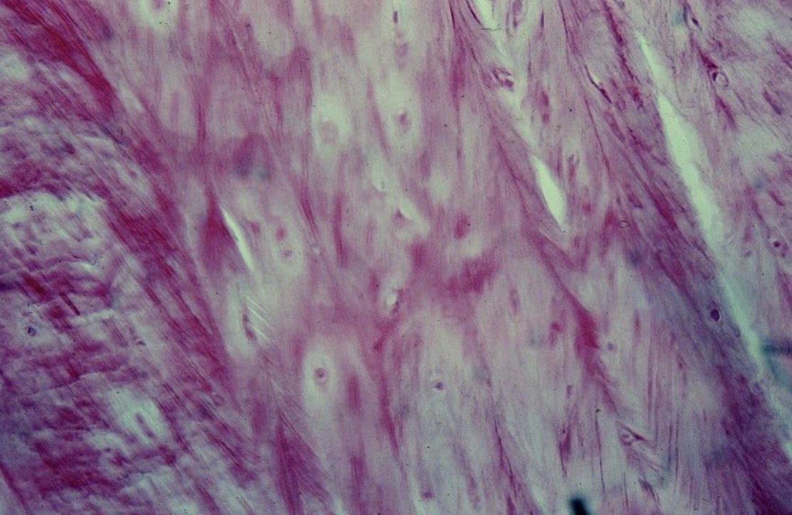 <p>Cart铆lago fibroso</p>