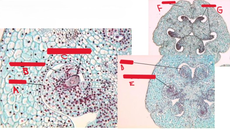 <p>identify a-g on the female sporangium</p>