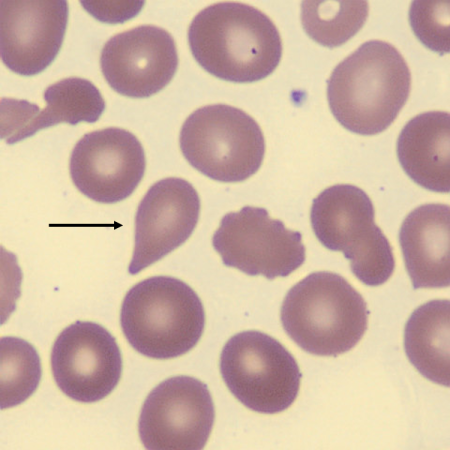 <p>What is the shape of this erythrocyte?</p>