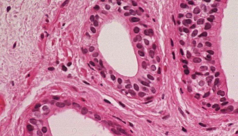 <p>lines salivary gland ducts/sweat glands </p><p>uncommon types of epithelium (has a very limited distribution)</p><p>only 2 layers with a basal layer of cells often appearing incomplete </p>