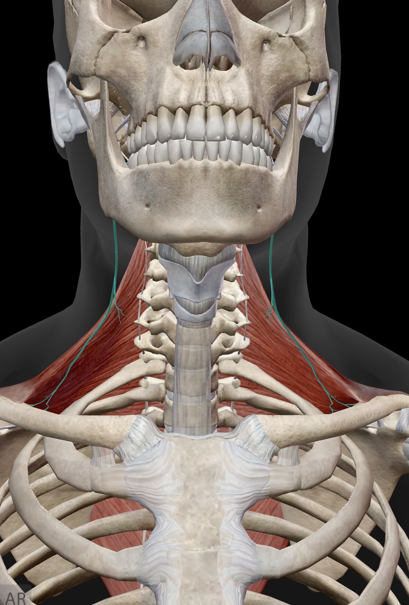 <p>CN XI spinal accessory nerve</p><p>Trapezius</p>