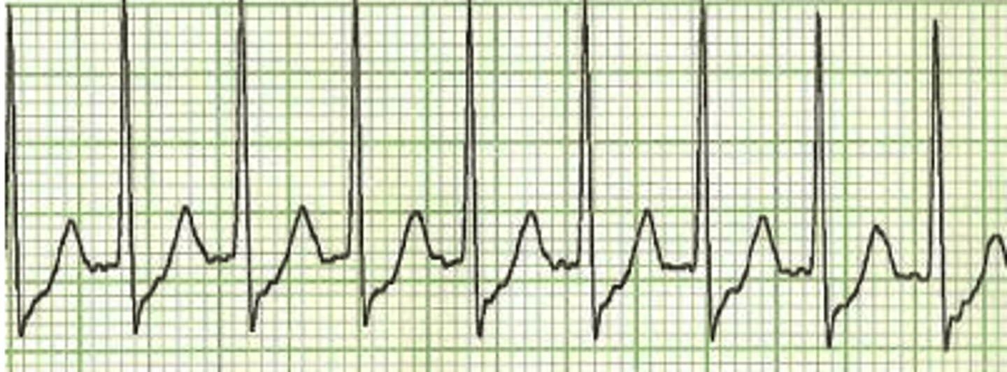 <p>Rhythm?</p><p>Management?</p>