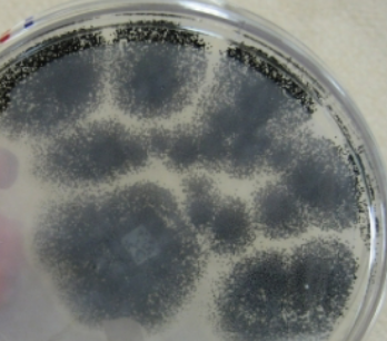 <p>What is this?</p><ul><li><p>where are its spores found?</p></li><li><p>can cause what?</p></li></ul><p></p>