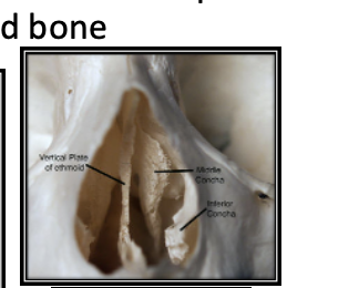 <p>Nasal concha</p>