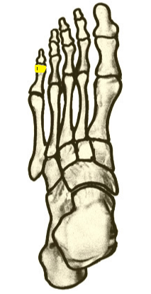 Name the highlighted foot bone