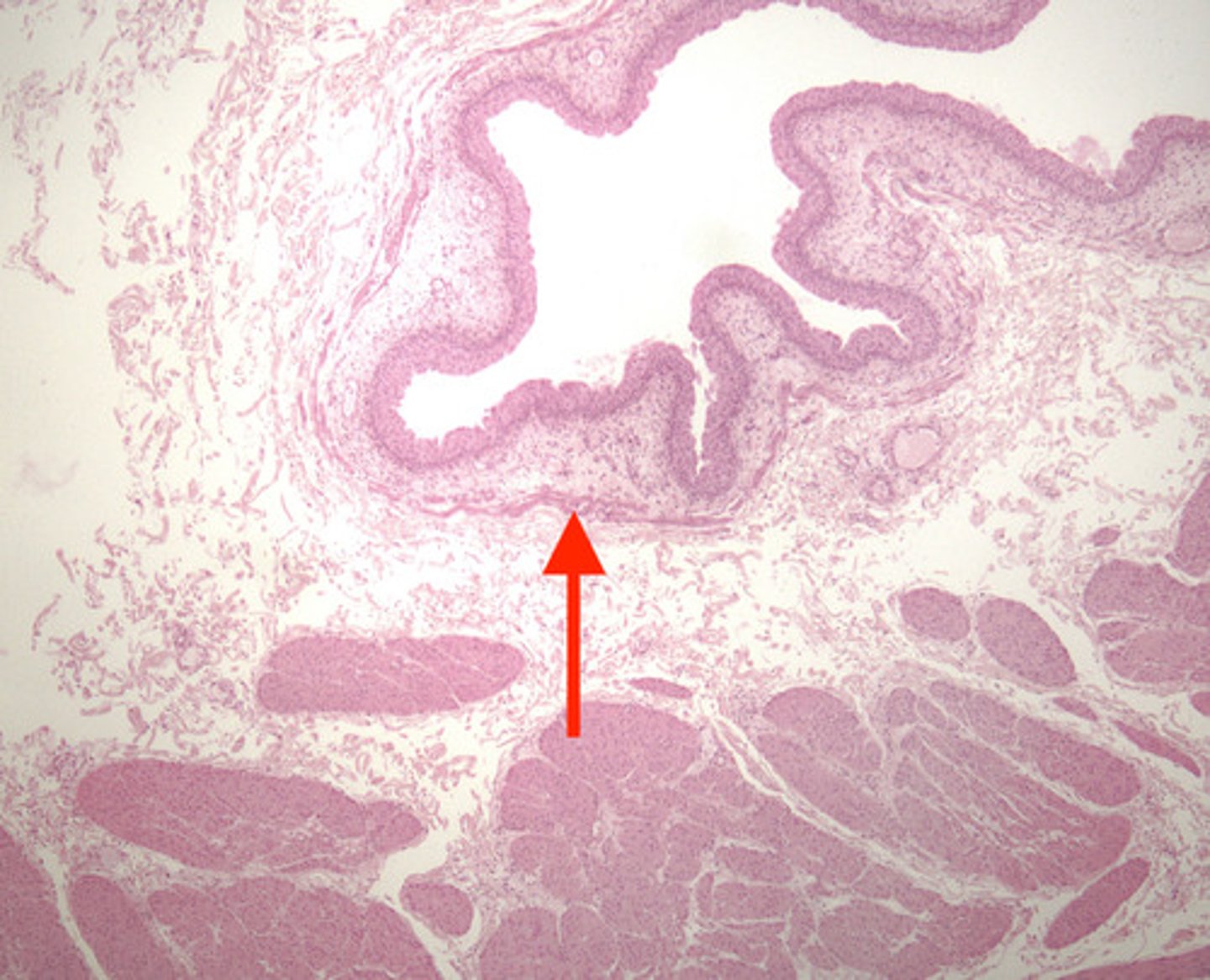 <p>because this bladder has this layer, what species can it NOT be?</p>