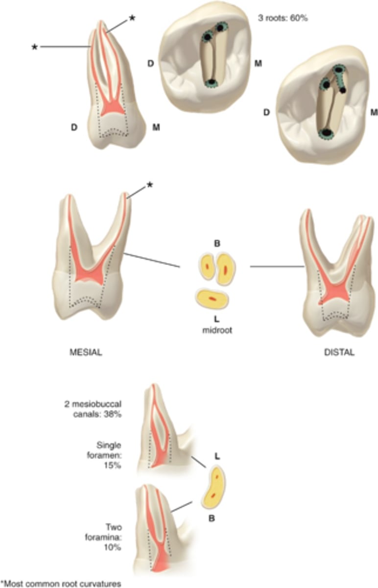 <p>Maxillary second molar access shape</p>