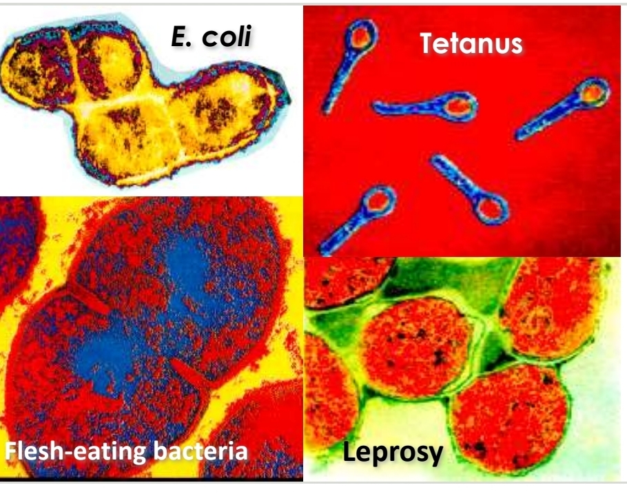 <p>Pathogenic Prokaryotes</p>