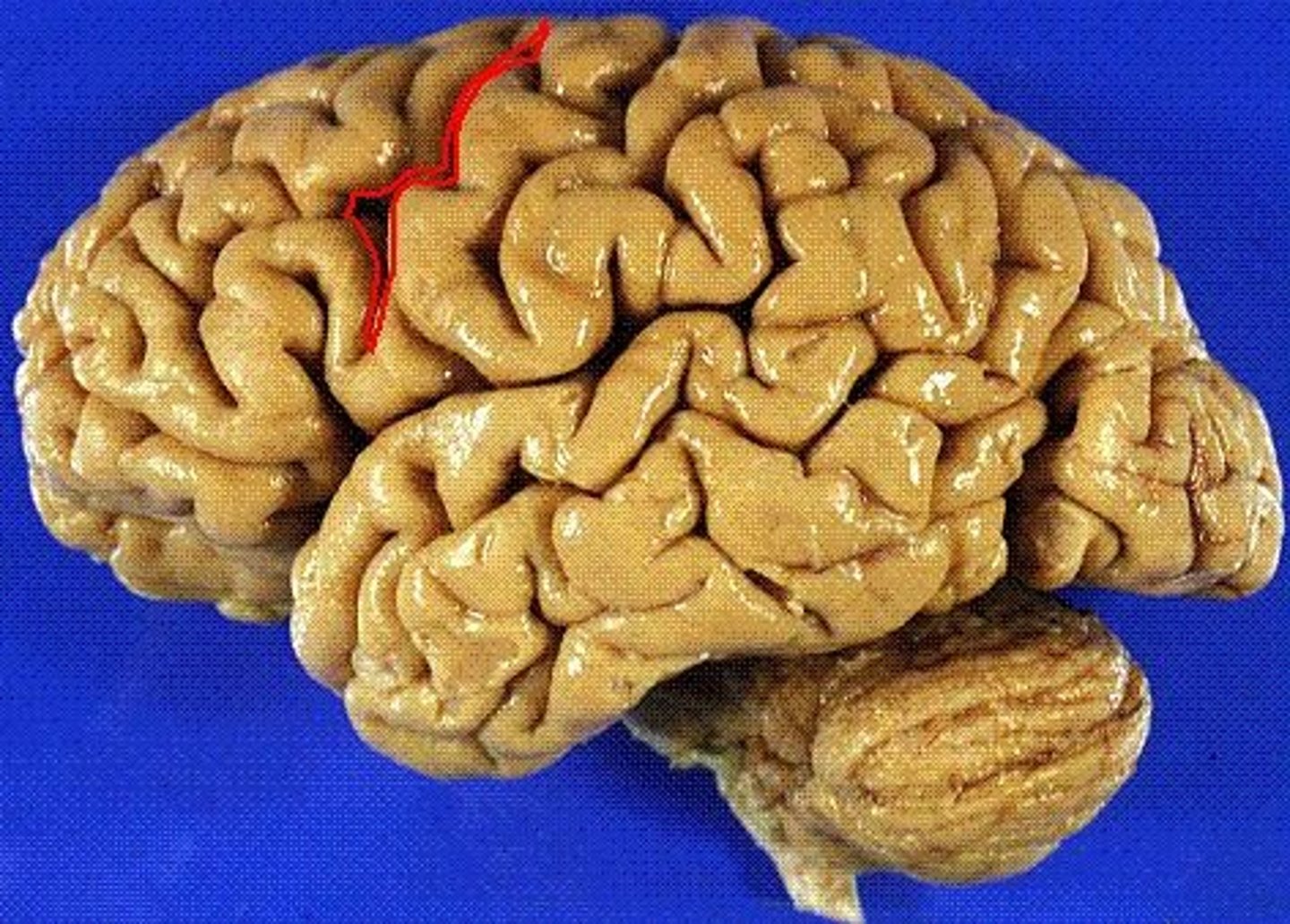 <p>- creates the anterior border of the motor cortex</p>
