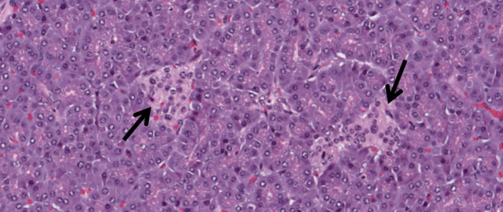 <p>what structure in the pancreas is indicated by the arrows?</p>